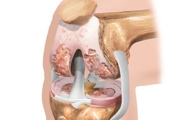 Ligament Program