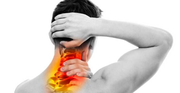 Neck pain and signs of Napp in osteochondrosis