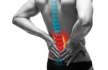 Osteochondrosis is a spinal disease