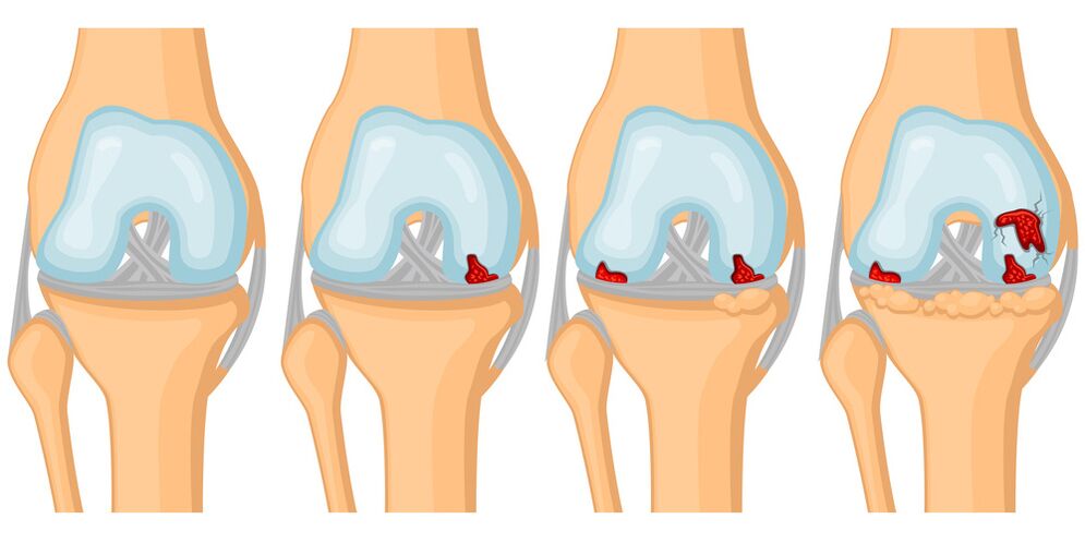degree of joint development