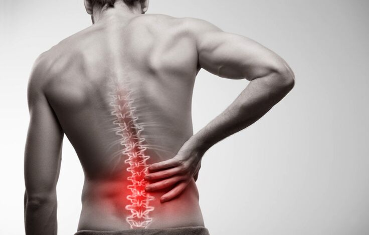 Low back pain caused by osteochondrosis